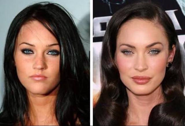 Why have so many white women had their lips done?