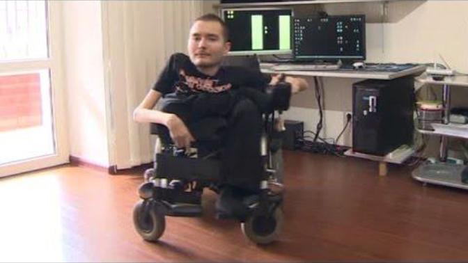 Do you think the very first head transplant surgery is possible yes you read it right head not hair?