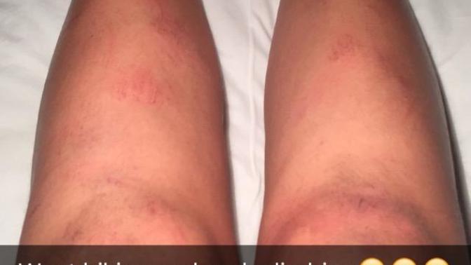 Would you be turned off if a girl showed up with legs like this on a date?