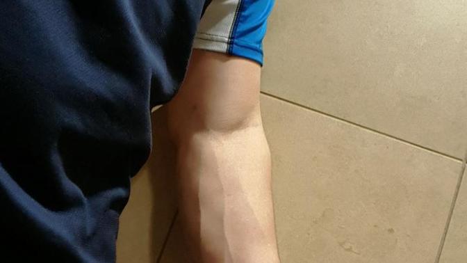 Do girls like arms with veins?