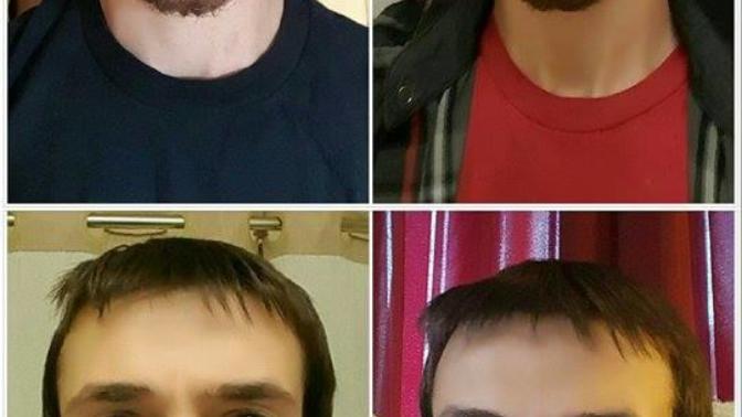 Girls, What is your take on guys who look younger than their age. (Or some would say have a "baby face")?