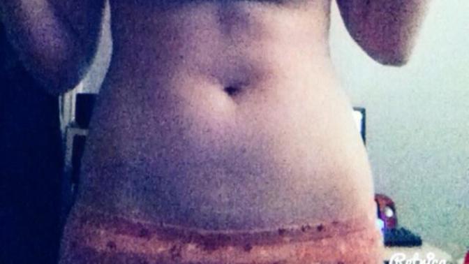 Do you think my stomach is okay?