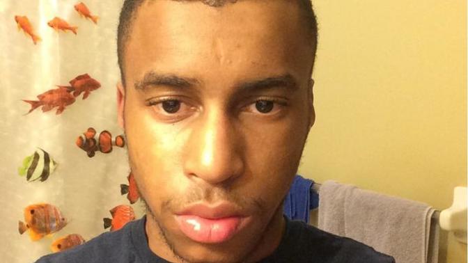 Girls, do you care if a guy has a facial scar?