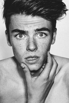 Do you think moles/freckles are attractive?