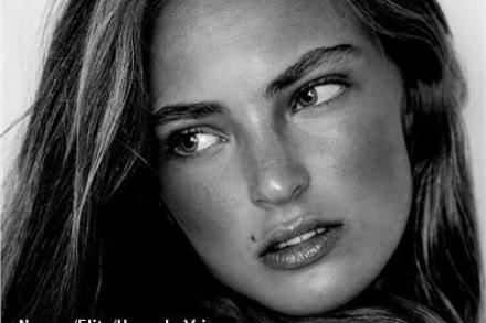 Do you think moles/freckles are attractive?