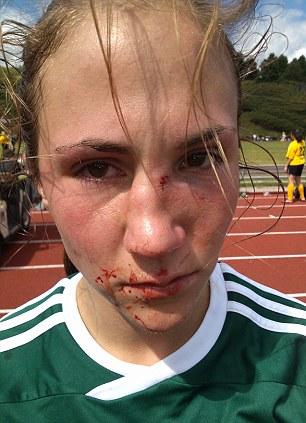 Was I justified for breaking my ex girlfriend's nose?
