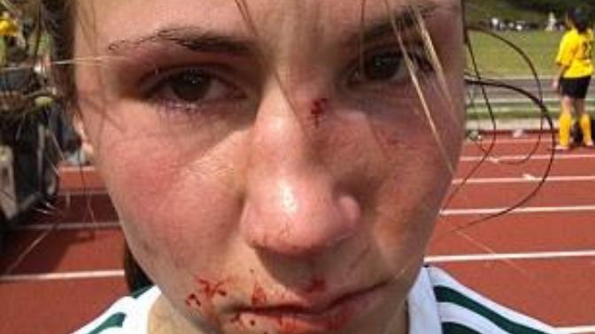 Was I justified for breaking my ex girlfriend's nose?