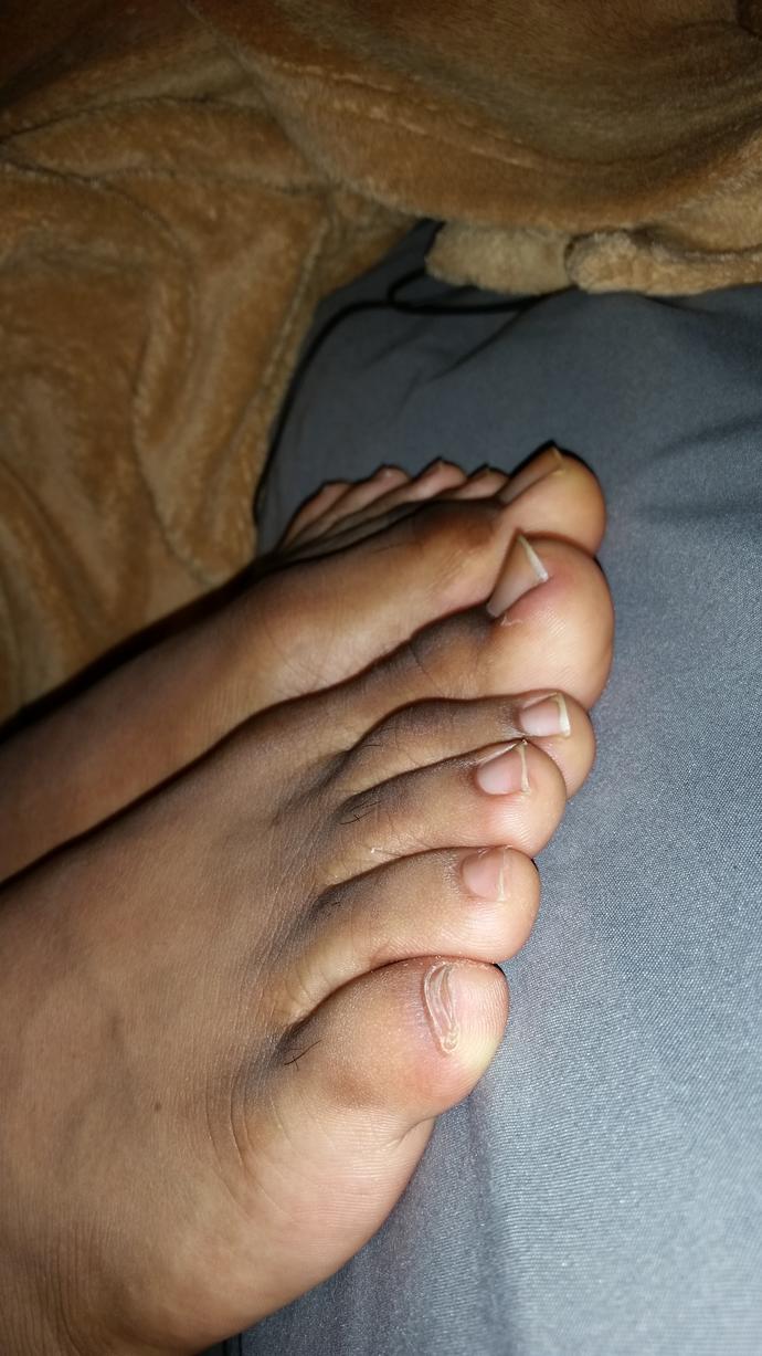 Girls, what guy that you know has nice toes like these?