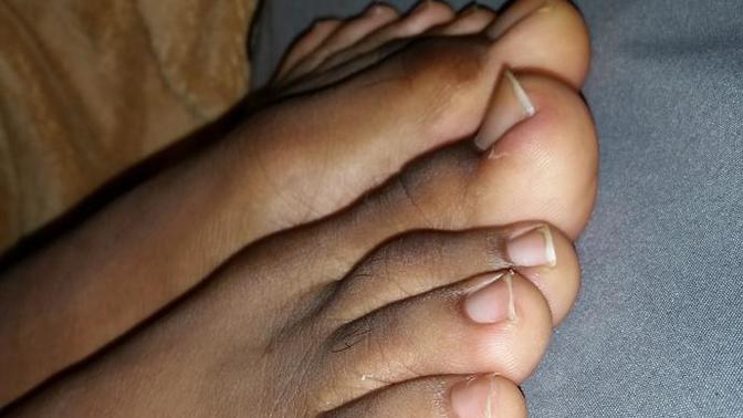Girls, what guy that you know has nice toes like these?