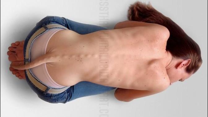 Have you ever seen a human with tail in real life?