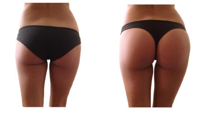 In general, would you say that this is the ideal butt for white and Asian men?