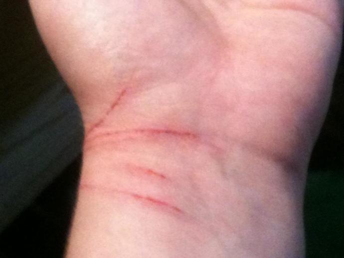 My best friend cuts herself to get attention?