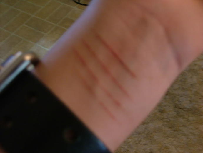 My best friend cuts herself to get attention?