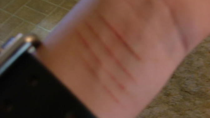 My best friend cuts herself to get attention?