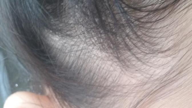 Am I losing hair on the side of my hair ): (pic)?