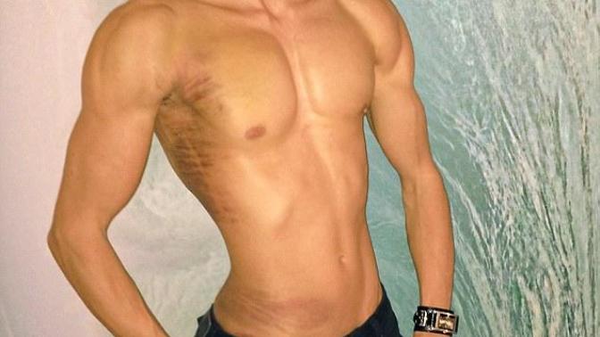 What do you think of Justin Jedlica, the Living Ken Doll?