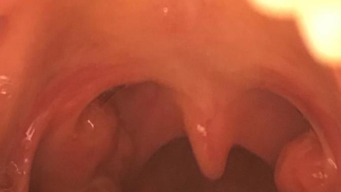Is it normal? *warning* this may seem graphic to some?