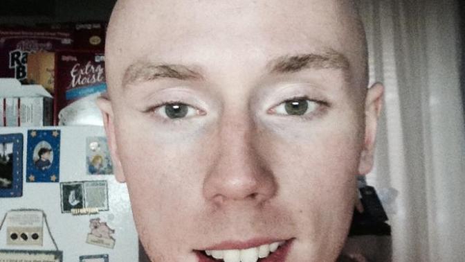Girls 18-24, would you consider me attractive or dateable despite this condition?