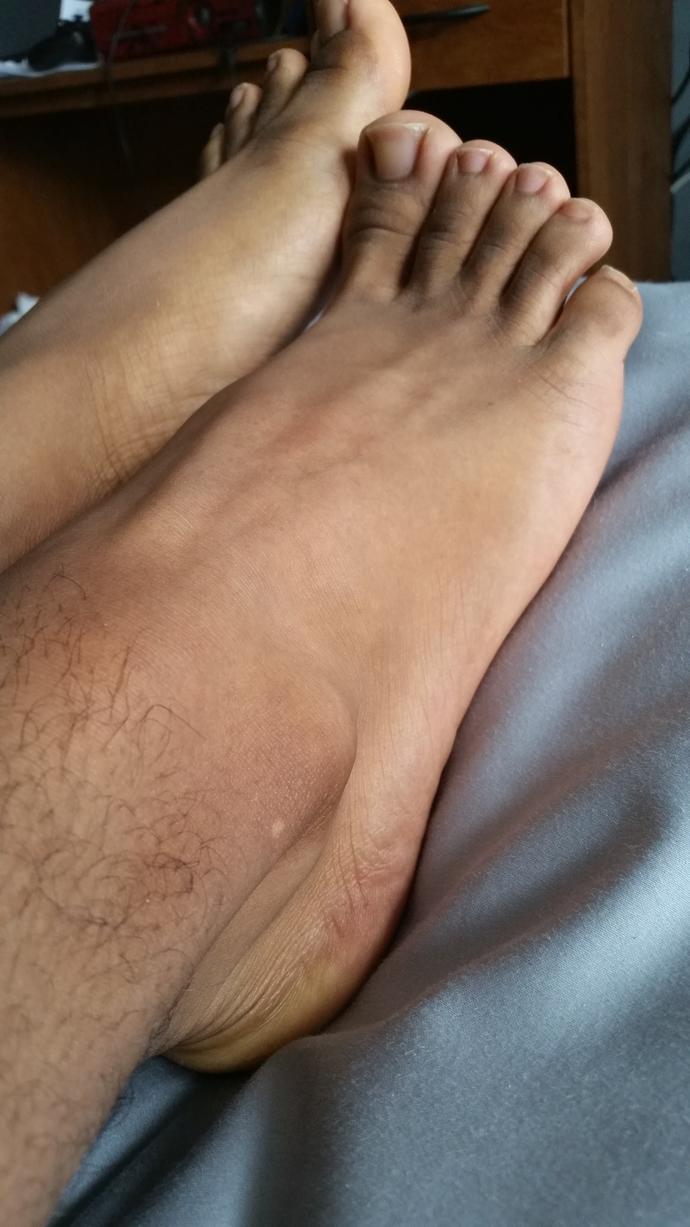 Which one of these feet do you like the most?