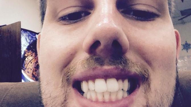 Girls, Do you think my teeth are crooked and unattractive? Should I look into straightening them?