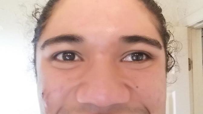 Should I get braces to fix the gap in my teeth? I'm already 22?