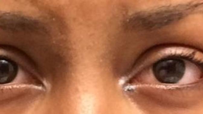 What do your eyes look like while high?