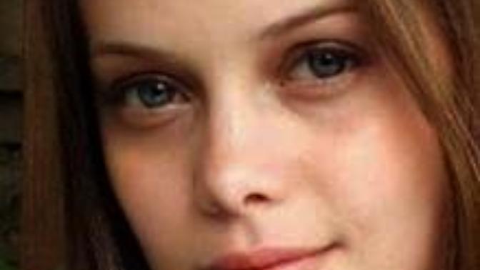 Are people with eye bags attractive?
