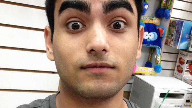 I am going bald! I am turning 20 in March. I am so young. I feel depressed! What do I do?