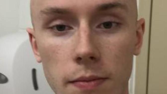 Girls, college age (early or mid 20's) do I pass your look requirement/do you find me attractive enough to date despite my condition?