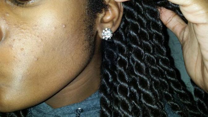 Girls, SKINCARE HELP?