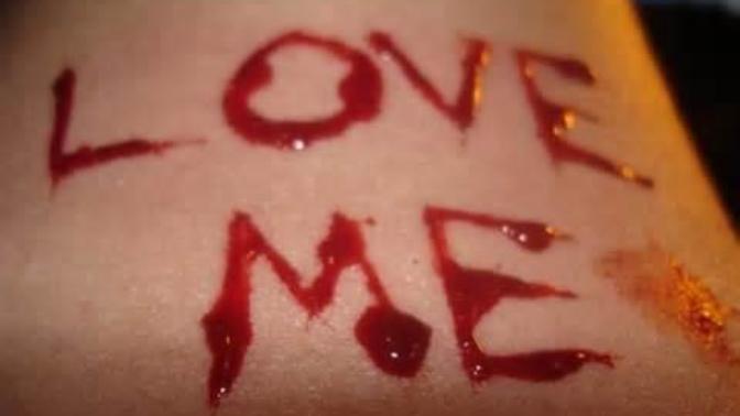 What would you do if you saw these marks on a girl you go to school with? Your reaction please read the details?