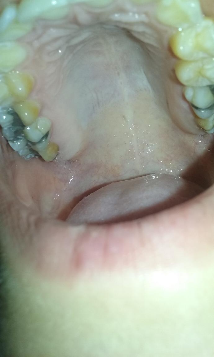Yellow teeth , Can I ever get white teeth please don't judge (4 pics)?
