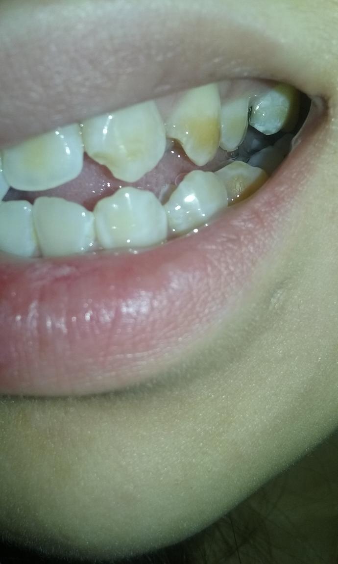 Yellow teeth , Can I ever get white teeth please don't judge (4 pics)?