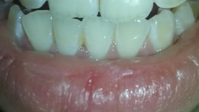 Yellow teeth , Can I ever get white teeth please don't judge (4 pics)?
