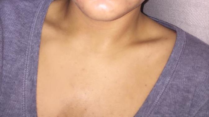 I HATE my lips? Picture?