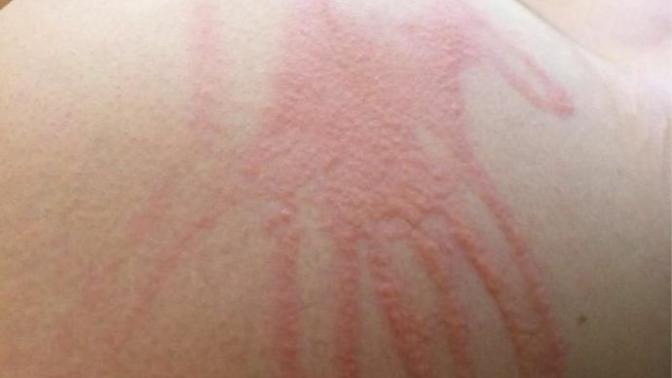 Girls, would you ever get your ass branded?
