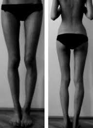 Do you prefer toned or thigh gap?