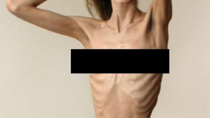Which body extreme would you rather date?