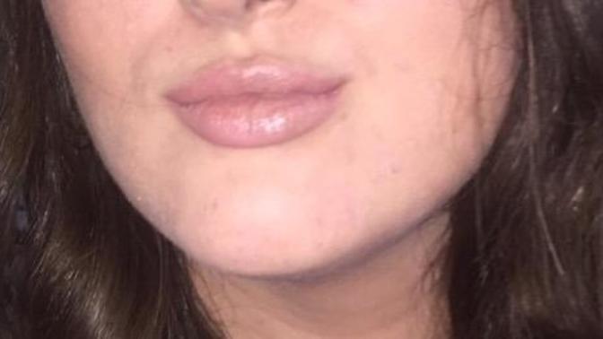Do guys care about lips?