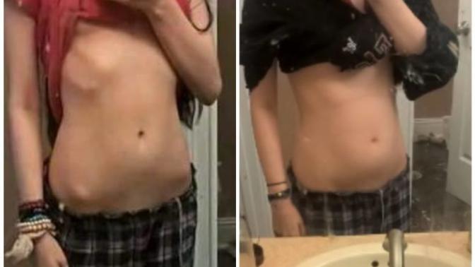 DO I NEED to lose weight again?
