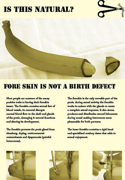 Circumcised guys if you had the chance to get your amputated limb restored to how nature intended would you?