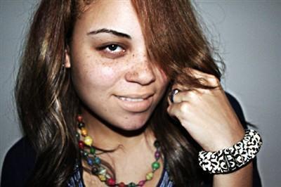 Freckles, Sexy or not?