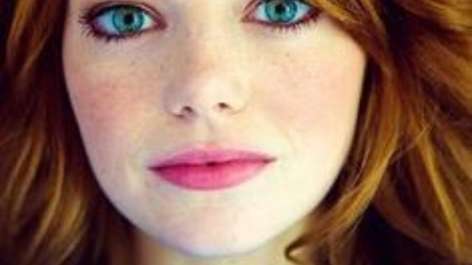 Freckles, Sexy or not?
