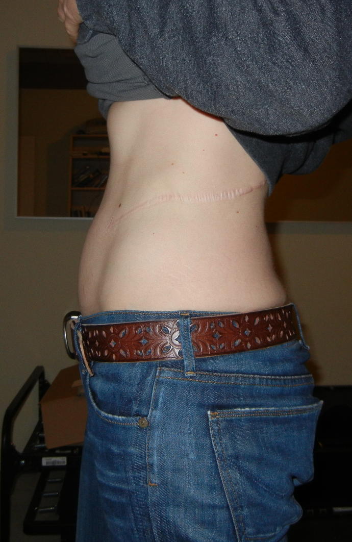 Girls, do you wear a belt if you have a slightly large belly?