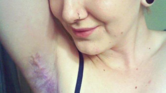 (Pictures) Guy's do you think dyed armpit hair look attractive on women? & Ladys would you try this?