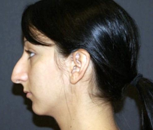 Do you find a girl with this type of nose attractive?