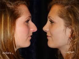 Do you find a girl with this type of nose attractive?