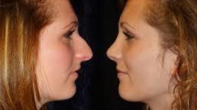 Do you find a girl with this type of nose attractive?