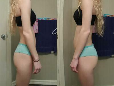 Why Is One Buttock Bigger Than The Other