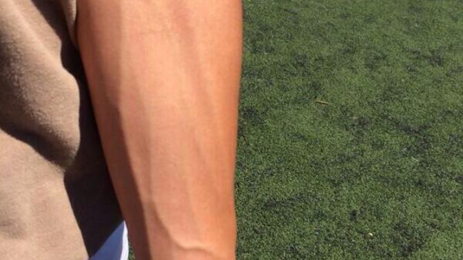 Girls, do you find veins attractive?